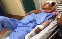 nghe an bo mac nan nhan bi can nat tay ngat xiu giua duong tai xe phong xe bo tron