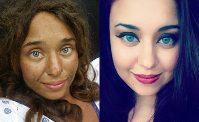 mat tich trong rung gan 1 thang co gai van song sot day ky tich nho an qua dai va nam