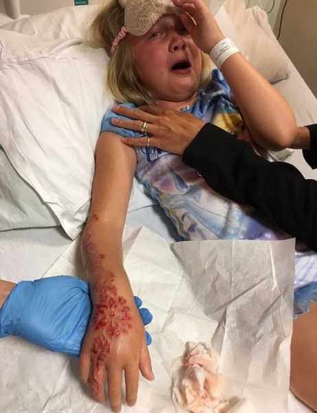 xam henna o tay trong chuyen du lich ai cap be gai nhan hau qua khung khiep