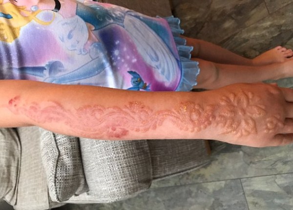 xam henna o tay trong chuyen du lich ai cap be gai nhan hau qua khung khiep