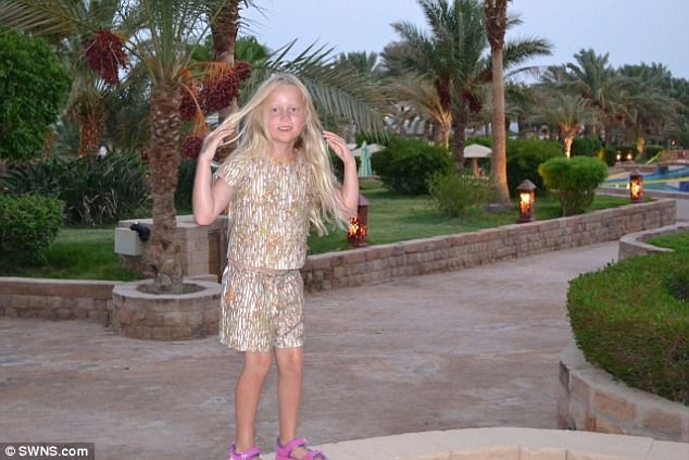 duoc bo thuong cho ve henna len tay be gai 7 tuoi da phai khoc dau don khi canh tay bong rop dang so