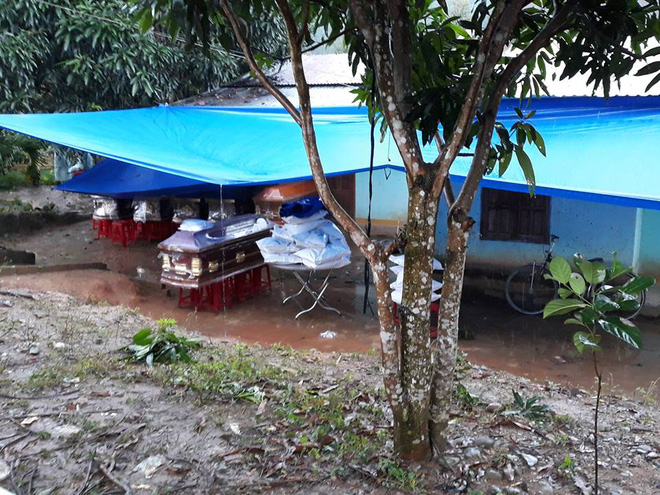 nan nhan bi thuong trong vu no bom 6 nguoi chet phai cat cut 2 chan bac si yeu cau bo 2 mat