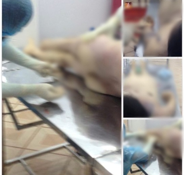 nu benh nhan 54 tuoi o ha noi tu vong bat thuong sau 2 ngay mo chan