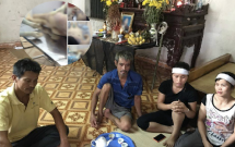 nu benh nhan 54 tuoi o ha noi tu vong bat thuong sau 2 ngay mo chan