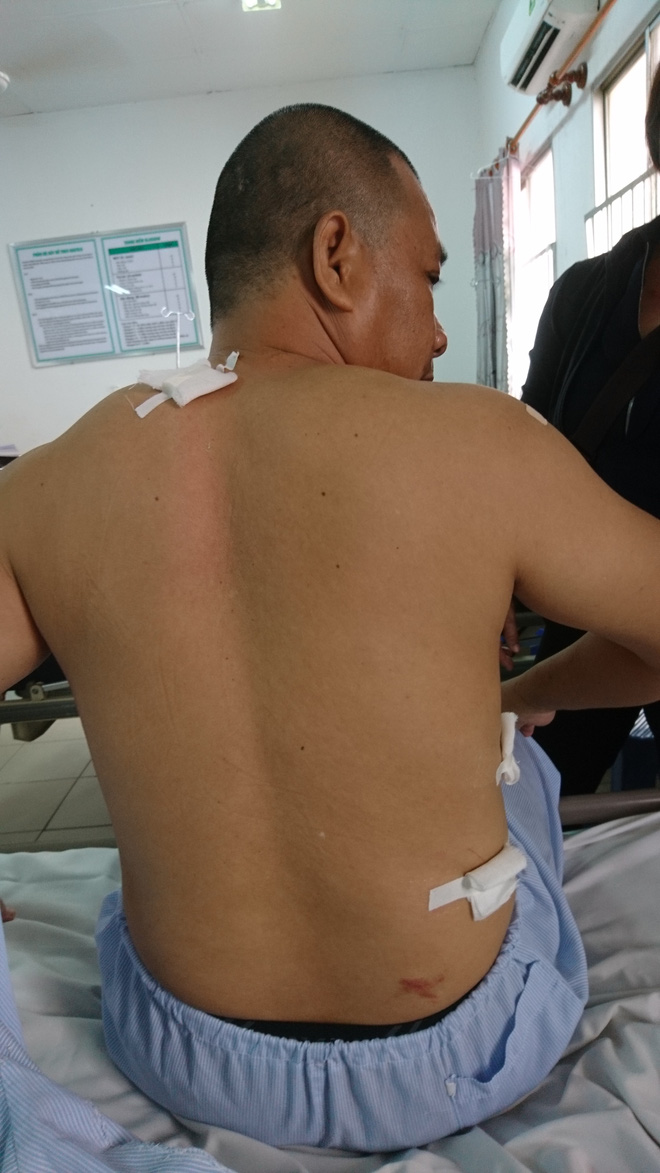 tphcm nguoi dan ong vao phong cap cuu van bi nhom thanh nien truy sat