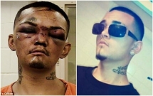 thanh nien sang chanh bi danh bam mat vi dam tran lot xe cua 3 cau thu bong bau duc