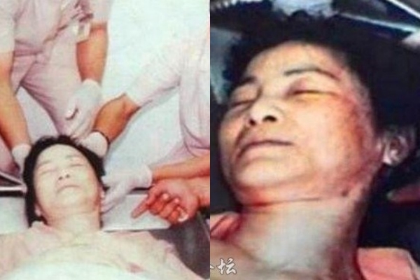 vi nhung tinh tiet nay nguoi ham mo chua bao gio tin dang le quan chet vi benh hen suyen tai phat