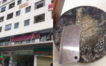 co gai nem dao thot tu tang 11 chung cu linh dam co bieu hien tram cam sau sinh