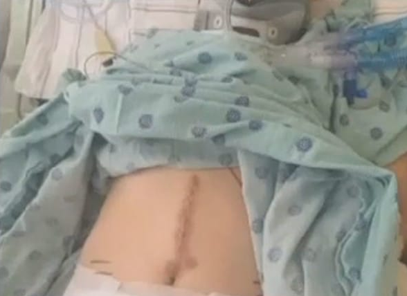 be gai 6 tuoi gap tai nan suyt bi cat dut doi nguoi vi mot thoi luoi nguy hiem cua bo me