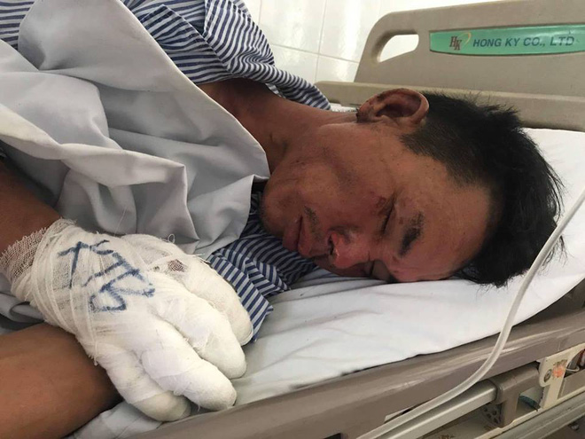 he lo nguyen nhan re cu mang xang dot nha va dam bo vo bi thuong o ha noi