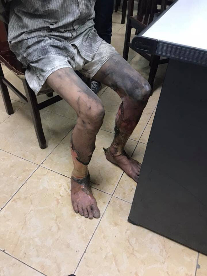 he lo nguyen nhan re cu mang xang dot nha va dam bo vo bi thuong o ha noi
