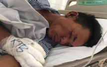 he lo nguyen nhan re cu mang xang dot nha va dam bo vo bi thuong o ha noi