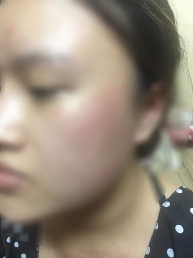 mot nu sinh thue tro bi nam chu nha tat vao mat sau thac mac tai sao thu tien bon em roi ma cuoi thang con chua dong tien dien