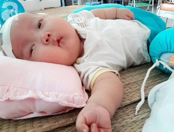 me tre dau don cau xin manh thuong quan cuu con trai bi nao ung thuy tu luc 2 thang tuoi