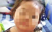 tiem ngua bi nhiem trung be gai 32 thang tuoi phai phau thuat dui trai 3 lan