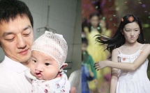 con gai 13 tuoi khuyet tat cua ly a bang cuoc song nhieu ton thuong va khac nguoi