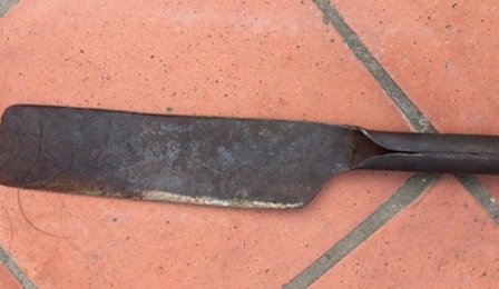 bac giang chong dung dao chem trong thuong vo co bau sap sinh