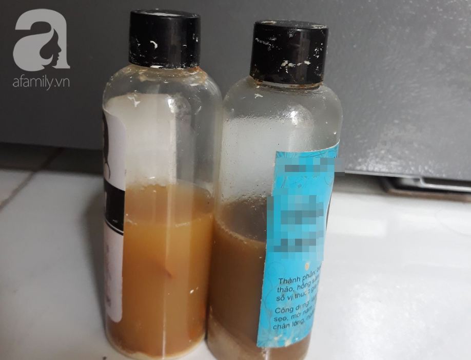 dung my pham dan toc mong da dep lot xac co gai 19 tuoi bi bien dang ca mat mat hip lai va sung vu kinh di