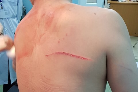 biet tin vo thue sat thu chem minh bac si chiem quoc thai soc chu khong con vui hay ha he