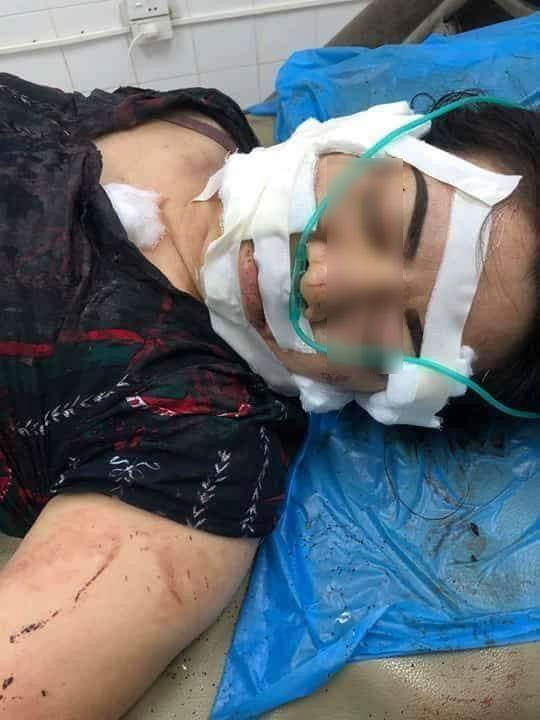 qua 3 lan do nguoi phu nu bac giang van khong tranh khoi kiep gian truan bi chong rach mat cat gan chan vi cuong ghen