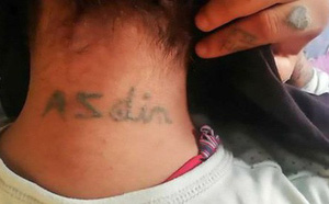 nhat duoc mon do choi trong nha may bo hoang cau be 11 tuoi dem nghich roi mat ca 2 tay