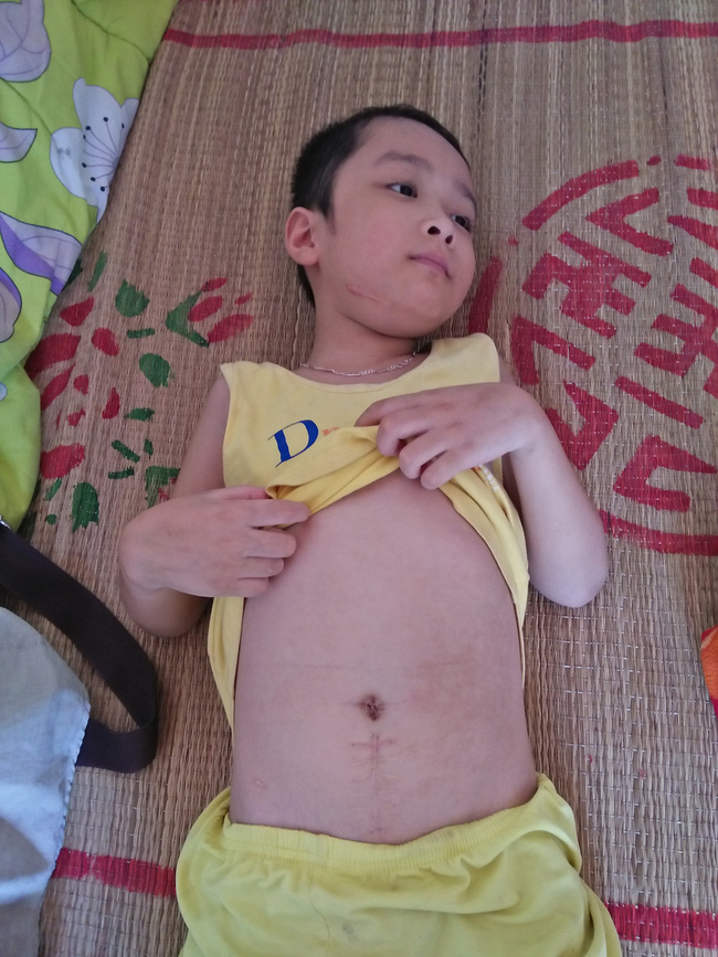 anh mat cau cuu cua hai dua tre cung mac phai can benh dong mau khong tien chua tri o nghe an