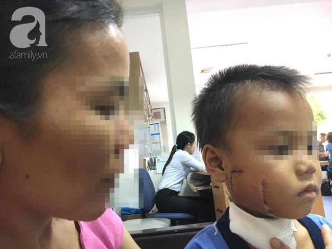 dua con den lo gach lam viec cha me khoc ngat vi be gai 6 tuoi bi canh quat chem thau xuong ham nguy kich