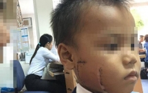 dua con den lo gach lam viec cha me khoc ngat vi be gai 6 tuoi bi canh quat chem thau xuong ham nguy kich