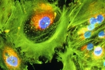 tin mung cho benh nhan ung thu than