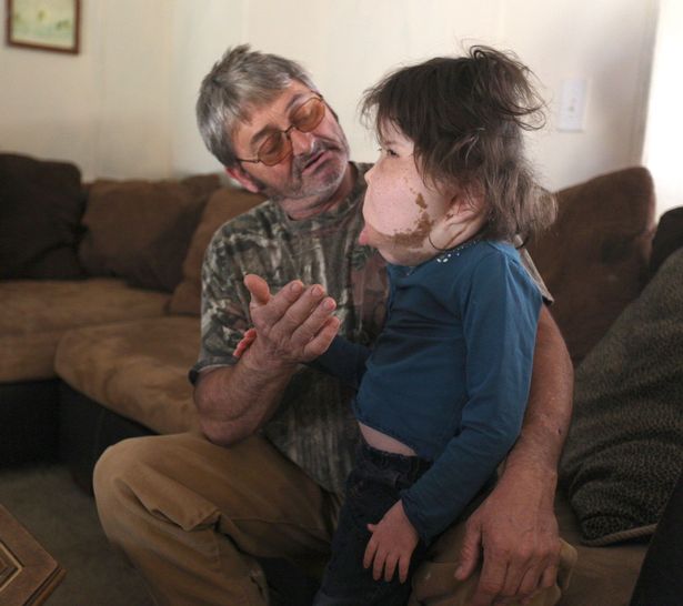 be gai 9 tuoi mac chung benh la lung khong ten trai qua vo so cuoc phau thuat