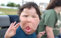 be gai 9 tuoi mac chung benh la lung khong ten trai qua vo so cuoc phau thuat