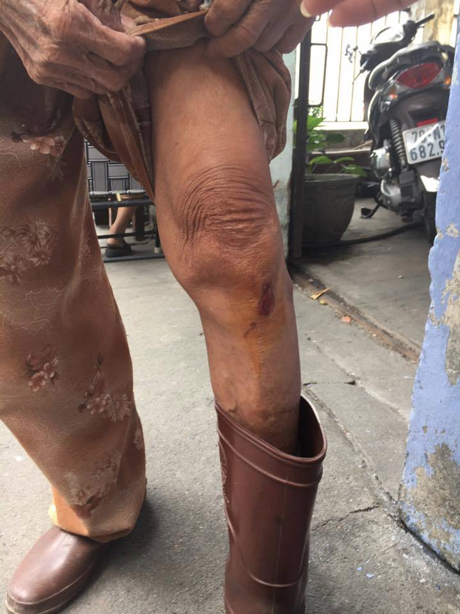 cu ba 80 tuoi bi nam thanh nien giat 560 to ve so va 400 nghin dong