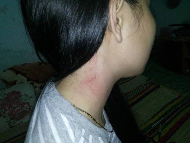 da nang co gai tre bi dong nghiep thue con do den tan nha tro dan mat trong dem