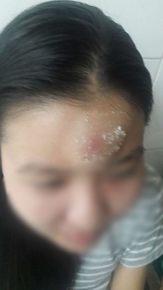 da nang co gai tre bi dong nghiep thue con do den tan nha tro dan mat trong dem