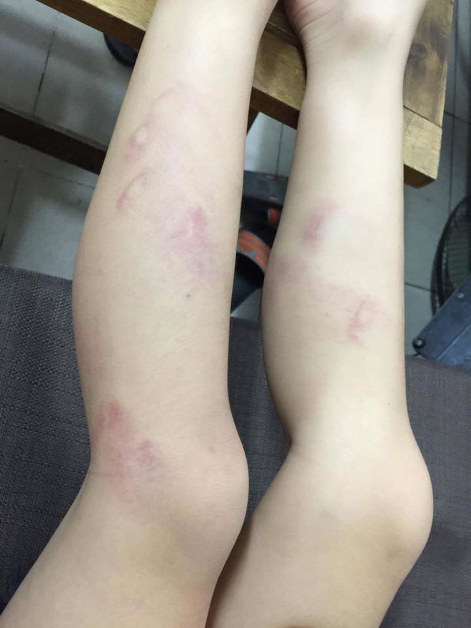 ha noi hoc sinh lop 2 bi co giao danh gay thuoc tham tim hai chan do vao lop muon sau gio ra choi