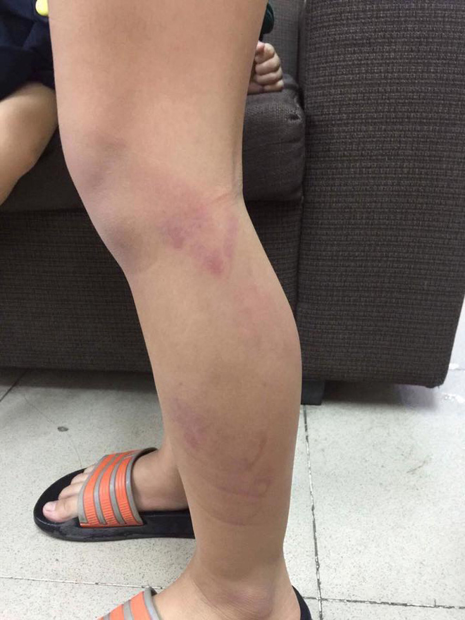 ha noi hoc sinh lop 2 bi co giao danh gay thuoc tham tim hai chan do vao lop muon sau gio ra choi