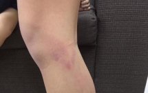 ha noi hoc sinh lop 2 bi co giao danh gay thuoc tham tim hai chan do vao lop muon sau gio ra choi