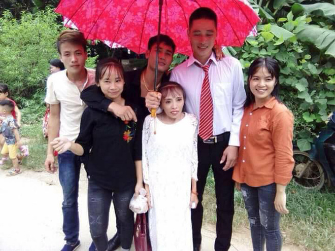 bi gia dinh ngan can vi co dau thap coi suy dinh duong chu re lang son van quyet ve chung 1 nha