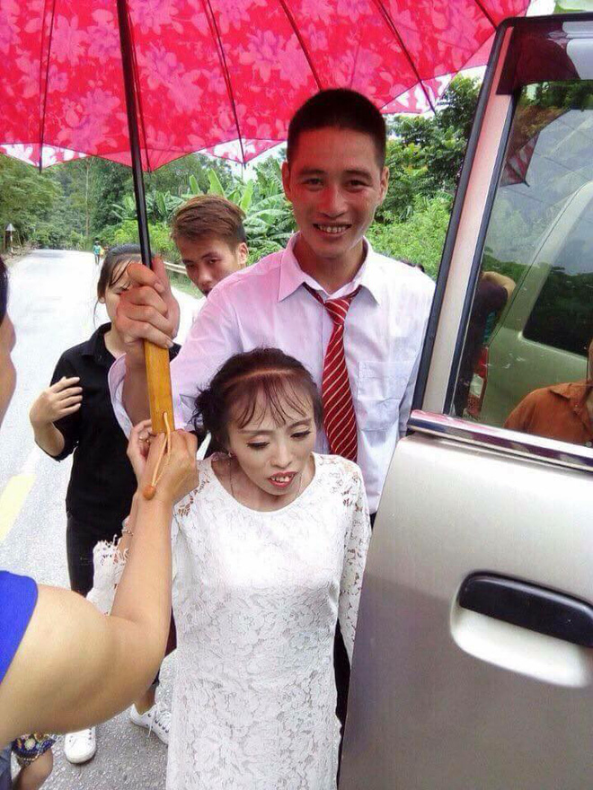 bi gia dinh ngan can vi co dau thap coi suy dinh duong chu re lang son van quyet ve chung 1 nha