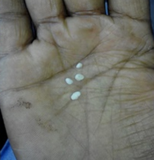 co be 11 tuoi khoc ra nhung hat bong gao trang muot