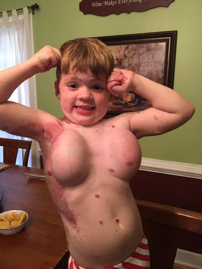 me dau don khi nhin thay 80 co the cua con so sinh phu day vet bot vay nhung do van chua phai la dieu toi te nhat