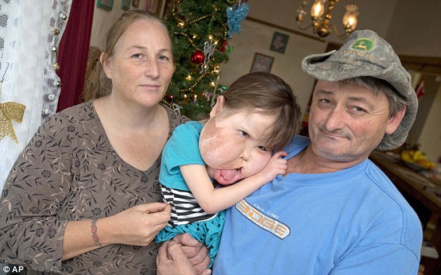 mac benh hiem ca bac si cung chua dat ten be gai 9 tuoi mang guong mat khong lo bien dang