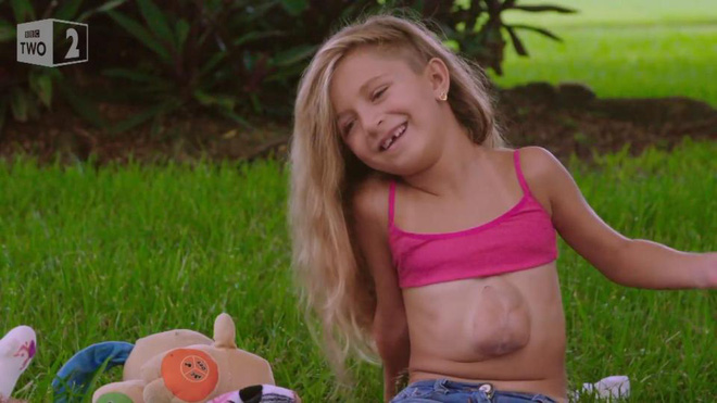 gap go be gai co qua tim moc ngay ngoai long nguc