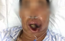 nguoi dan ong suyt tu vong vi tu y nan mun to o moi