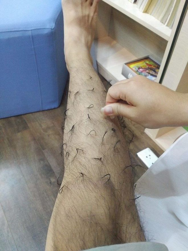 13 noi long cua nhung anh chang thuong xuyen bi gau cho an hanh