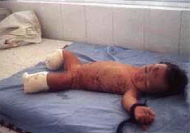 bo me om bom tu sat khien con tat nguyen co be goc viet vuot nghich canh tro thanh hy vong paralympic cua my