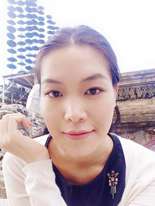 mat moc va ve goi cam cua hoa hau viet nam tuyen bo khong phau thuat tham my