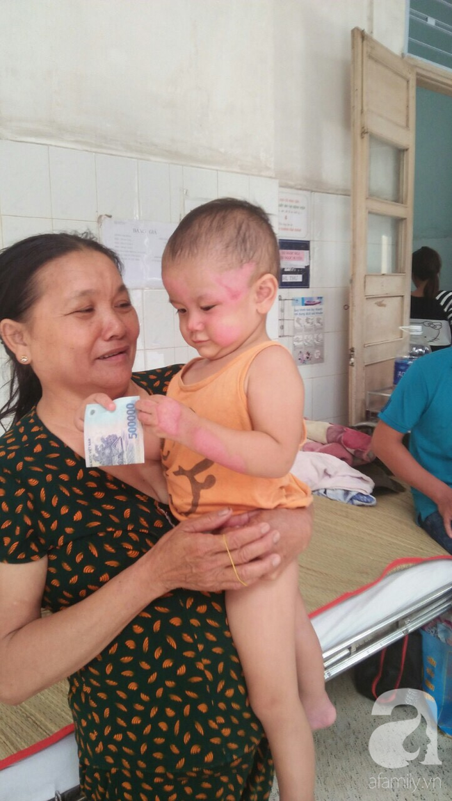 thuong tam vo bi xe rac can tu vong tren duong ve nha nguoi dan ong tuyet vong tim cach cuu doi chan cho con trai 1 tuoi