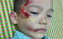 me tre to y ta ngoi buon dien thoai bo mac con trai bi thuong vi khong kip mang tien dong vien phi