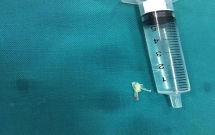 be trai 10 thang tuoi o nghe an hoc xuong ca gan 1 cm